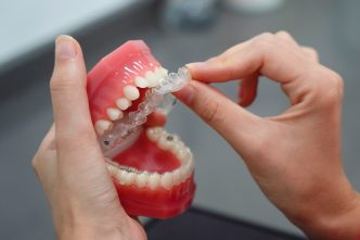 Dental Implants vs. Dentures: Why Implants Are the Gold Standard for Tooth Replacement