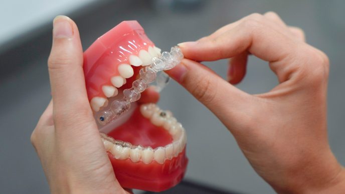 Dental Implants vs. Dentures: Why Implants Are the Gold Standard for Tooth Replacement